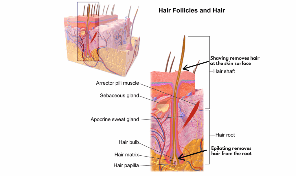 epilating removes hair from the root