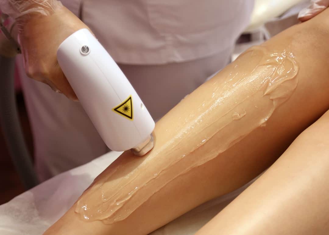 Is Laser Hair Removal Permanent? Get the Facts Here