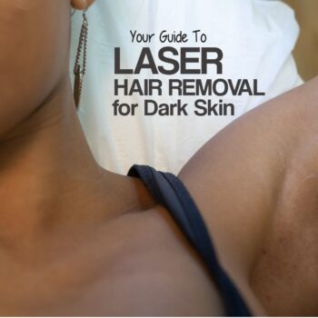 guide to laser hair removal for dark skin