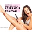 will hair grow back after laser hair removal